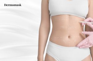 Cicatrices d’abdominoplastie Image de couverture Dermomask